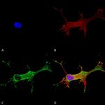 Notch1 Antibody in Immunocytochemistry (ICC/IF)