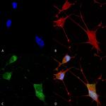 Neuroligin-1 Antibody in Immunocytochemistry (ICC/IF)