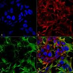 Neuroligin-3 Antibody in Immunocytochemistry (ICC/IF)