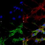 LRRK2/Dardarin Antibody in Immunocytochemistry (ICC/IF)