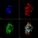 LRRK2/Dardarin Antibody in Immunocytochemistry (ICC/IF)