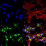 VDAC1 Antibody in Immunocytochemistry (ICC/IF)