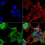 VDAC1 Antibody in Immunocytochemistry (ICC/IF)