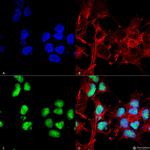 Choline acetyltransferase Antibody in Immunocytochemistry (ICC/IF)