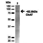 Choline acetyltransferase Antibody in Western Blot (WB)