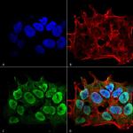 SHANK1/SHANK3 Antibody in Immunocytochemistry (ICC/IF)