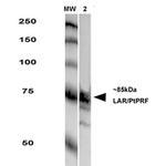 Protein Tyrosine phosphatase Receptor F (PTPRF) Antibody in Western Blot (WB)