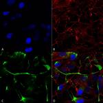 Activating Transcription Factor 4 (ATF4) Antibody in Immunocytochemistry (ICC/IF)