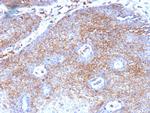 Beta-2 Microglobulin Antibody in Immunohistochemistry (Paraffin) (IHC (P))