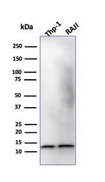 Beta-2 Microglobulin Antibody in Western Blot (WB)