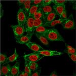 Beta-2 Microglobulin (Renal Failure and Tumor Marker) Antibody in Immunocytochemistry (ICC/IF)