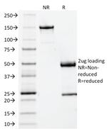 Beta-2 Microglobulin (Renal Failure and Tumor Marker) Antibody in SDS-PAGE (SDS-PAGE)
