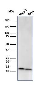 Beta-2 Microglobulin (Renal Failure and Tumor Marker) Antibody in Western Blot (WB)