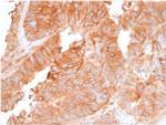 Beta-2 Microglobulin Antibody in Immunohistochemistry (Paraffin) (IHC (P))