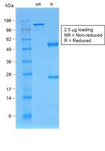 Beta-2 Microglobulin Antibody in SDS-PAGE (SDS-PAGE)