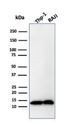 Beta-2 Microglobulin Antibody in Western Blot (WB)