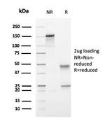 PMEPA1/TMEPAI (Tumor Suppressor Oncoprotein) Antibody in SDS-PAGE (SDS-PAGE)