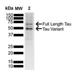 Tau Antibody in Western Blot (WB)