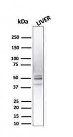 26S proteasome non-ATPase regulatory subunit 4 Antibody in Western Blot (WB)