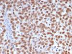 SALL-4 (Transcription Factor) Antibody in Immunohistochemistry (Paraffin) (IHC (P))