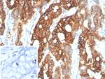 S100A14 (S100 calcium binding protein A14) Antibody in Immunohistochemistry (Paraffin) (IHC (P))