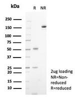 S100A14 (S100 calcium binding protein A14) Antibody in SDS-PAGE (SDS-PAGE)