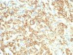 S100A14 (S100 calcium binding protein A14) Antibody in Immunohistochemistry (Paraffin) (IHC (P))