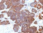 Parathyroid Hormone (PTH) Antibody in Immunohistochemistry (Paraffin) (IHC (P))