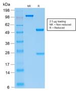 Parathyroid Hormone (PTH) Antibody in SDS-PAGE (SDS-PAGE)