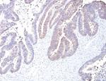 Cycloxygenase-2 (COX-2) Antibody in Immunohistochemistry (Paraffin) (IHC (P))