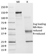 Cycloxygenase-2 (COX-2) Antibody in SDS-PAGE (SDS-PAGE)