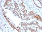 KIAA1967/DBC1/CCAR2 Antibody in Immunohistochemistry (Paraffin) (IHC (P))