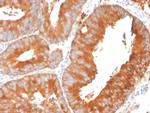 SLAMF7/CS1/CD319 Antibody in Immunohistochemistry (Paraffin) (IHC (P))