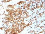 CD45RB Antibody in Immunohistochemistry (Paraffin) (IHC (P))