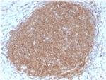 CD45RB Antibody in Immunohistochemistry (Paraffin) (IHC (P))