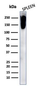 CD45RB Antibody in Western Blot (WB)