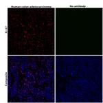 Ki-67 Antibody in Immunohistochemistry (Paraffin) (IHC (P))