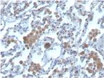 Ras-related C3 botulinum toxin substrate 1 Antibody in Immunohistochemistry (Paraffin) (IHC (P))