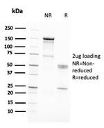 RAD51 (Prognostic and Response to Chemotherapy Marker) Antibody in SDS-PAGE (SDS-PAGE)