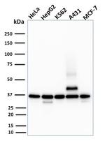 RAD51 (Prognostic and Response to Chemotherapy Marker) Antibody in Western Blot (WB)