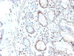 RAD51 Antibody in Immunohistochemistry (Paraffin) (IHC (P))