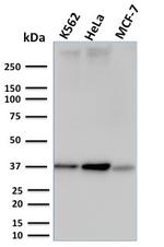 RAD51 (Prognostic and Response to Chemotherapy Marker) Antibody in Western Blot (WB)