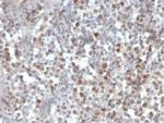 RAD51 Antibody in Immunohistochemistry (Paraffin) (IHC (P))