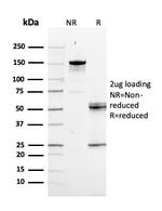 RAD51 Antibody in SDS-PAGE (SDS-PAGE)