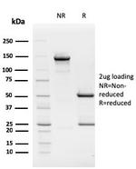 Rb1 (Tumor Suppressor Protein) Antibody in SDS-PAGE (SDS-PAGE)