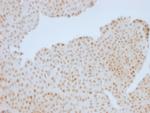 Rb1 (Tumor Suppressor Protein) Antibody in Immunohistochemistry (Paraffin) (IHC (P))