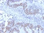 Rb1 (Tumor Suppressor Protein) Antibody in Immunohistochemistry (Paraffin) (IHC (P))