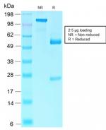 Rb1 (Tumor Suppressor Protein) Antibody in SDS-PAGE (SDS-PAGE)