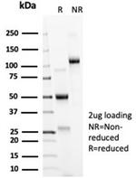 ACE2/Angiotensin I Converting Enzyme 2 Antibody in SDS-PAGE (SDS-PAGE)