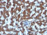 Retinol Binding Protein-1 (RBP1) Antibody in Immunohistochemistry (Paraffin) (IHC (P))